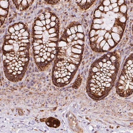 Merck Anti-PRELID3B antibody produced in rabbit