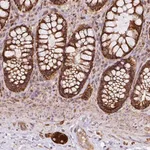 Merck Anti-PRELID3B antibody produced in rabbit