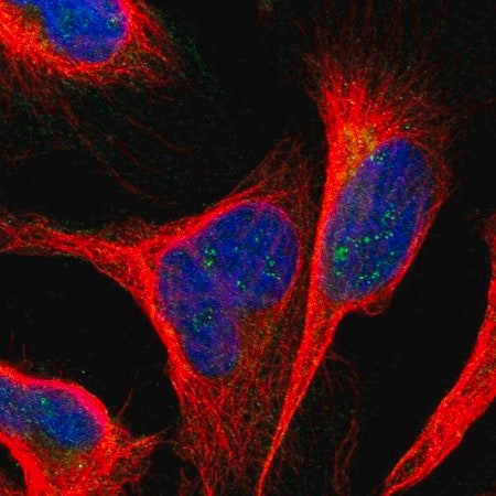 Merck Anti-ANKS6 antibody produced in rabbit