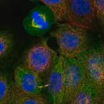 Merck Anti-PYCR3 antibody produced in rabbit