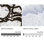 Merck Anti-GDF15 antibody produced in rabbit