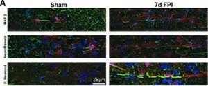 Merck MOUSE MONOCLONAL ANTI-NEUROFILAMENT 200&