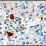 Merck ANTI-PANCREATIC POLYPEPTIDE/PPY