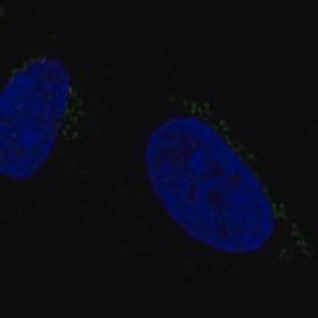Merck Anti-ALKBH7 antibody produced in rabbit