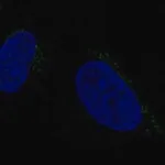 Merck Anti-ALKBH7 antibody produced in rabbit
