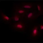 Merck ANTI-SMAD7, ANTIBODY PRODUCED IN RABBIT&