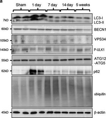 Merck Anti-VPS34 antibody produced in rabbit