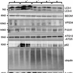 Merck Anti-VPS34 antibody produced in rabbit