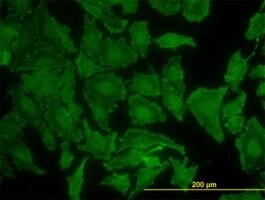 Merck MONOCLONAL ANTI-KRAS, ANTIBODY PRODUCED&
