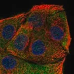 Merck Anti-CYB5D2 antibody produced in rabbit