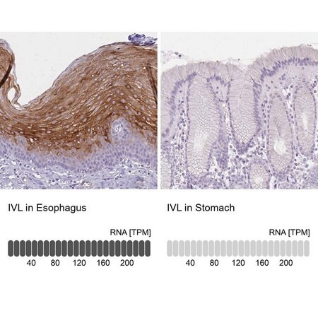 Merck Anti-IVL antibody produced in rabbit