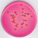 Merck Dichloran Rose bengal Agar (Base)NutriS&