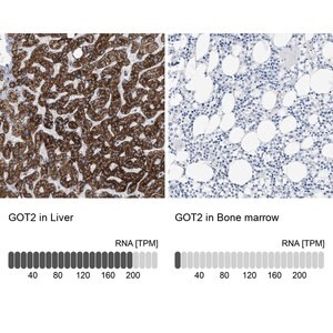 Merck ANTI-GOT2