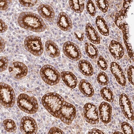 Merck Anti-RETNLB antibody produced in rabbit
