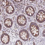 Merck Anti-MRPL11 antibody produced in rabbit