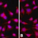 Merck ANTI-HISTONE DEACETYLASE (HDAC4) (ML-19)