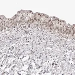 Atlas Antibodies Anti-RNF2 Antibody