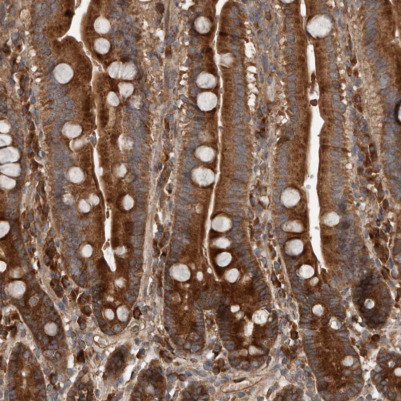 Atlas Antibodies Anti-RNF207 Antibody