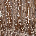 Atlas Antibodies Anti-RNF207 Antibody
