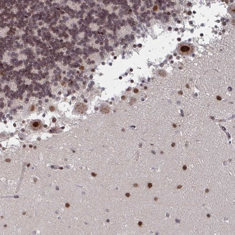 Atlas Antibodies Anti-RNF212 Antibody