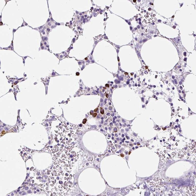 Atlas Antibodies Anti-RNF212B Antibody