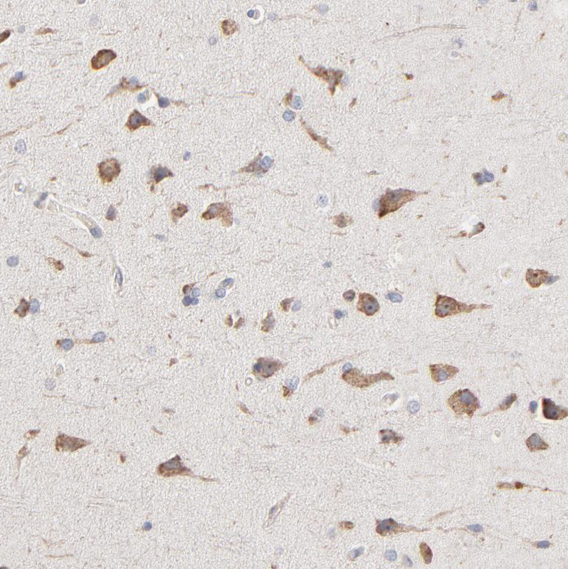 Atlas Antibodies Anti-RNF213 Antibody