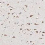 Atlas Antibodies Anti-RNF213 Antibody