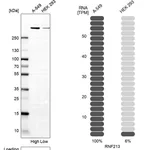Atlas Antibodies Anti-RNF213 Antibody