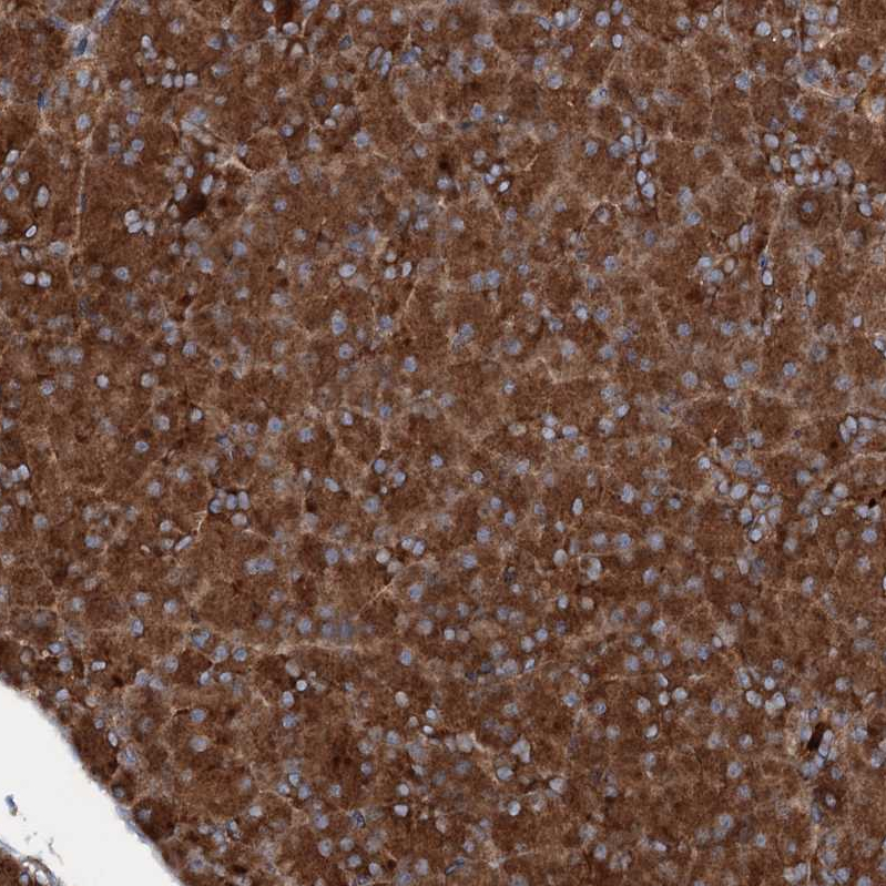Atlas Antibodies Anti-RNF214 Antibody