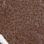 Atlas Antibodies Anti-RNF214 Antibody