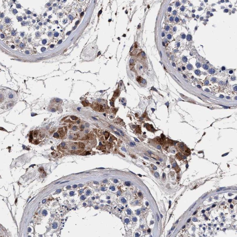Atlas Antibodies Anti-RNF208 Antibody
