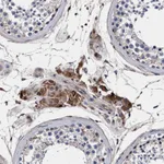Atlas Antibodies Anti-RNF208 Antibody