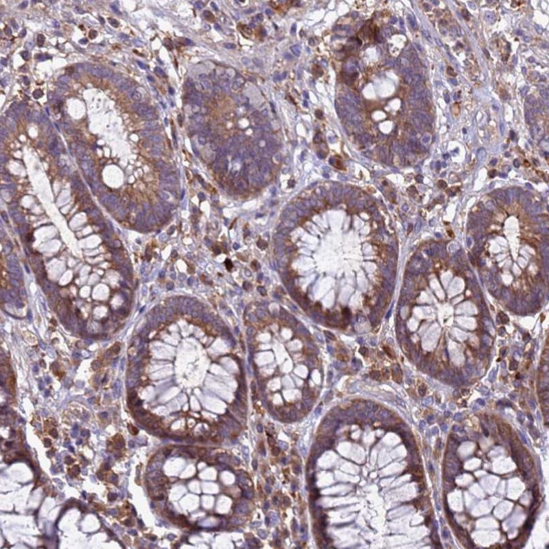 Atlas Antibodies Anti-RNF215 Antibody