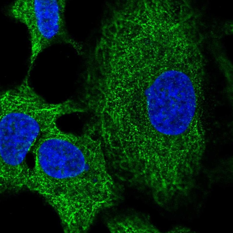 Atlas Antibodies Anti-RNF215 Antibody