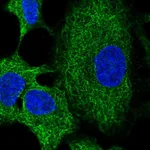 Atlas Antibodies Anti-RNF215 Antibody