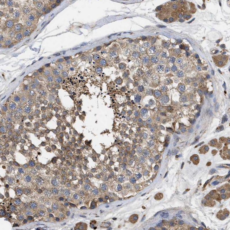 Atlas Antibodies Anti-RNF216 Antibody