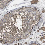Atlas Antibodies Anti-RNF216 Antibody
