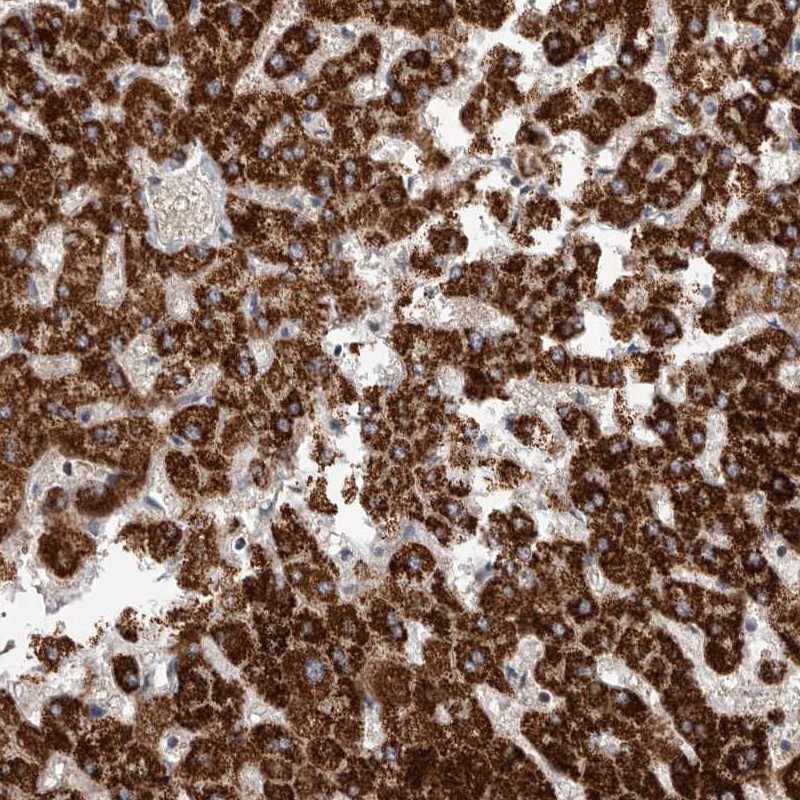 Atlas Antibodies Anti-RNF217 Antibody