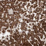 Atlas Antibodies Anti-RNF217 Antibody
