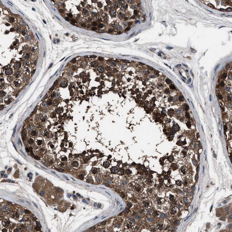 Atlas Antibodies Anti-RNF216 Antibody
