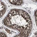 Atlas Antibodies Anti-RNF216 Antibody