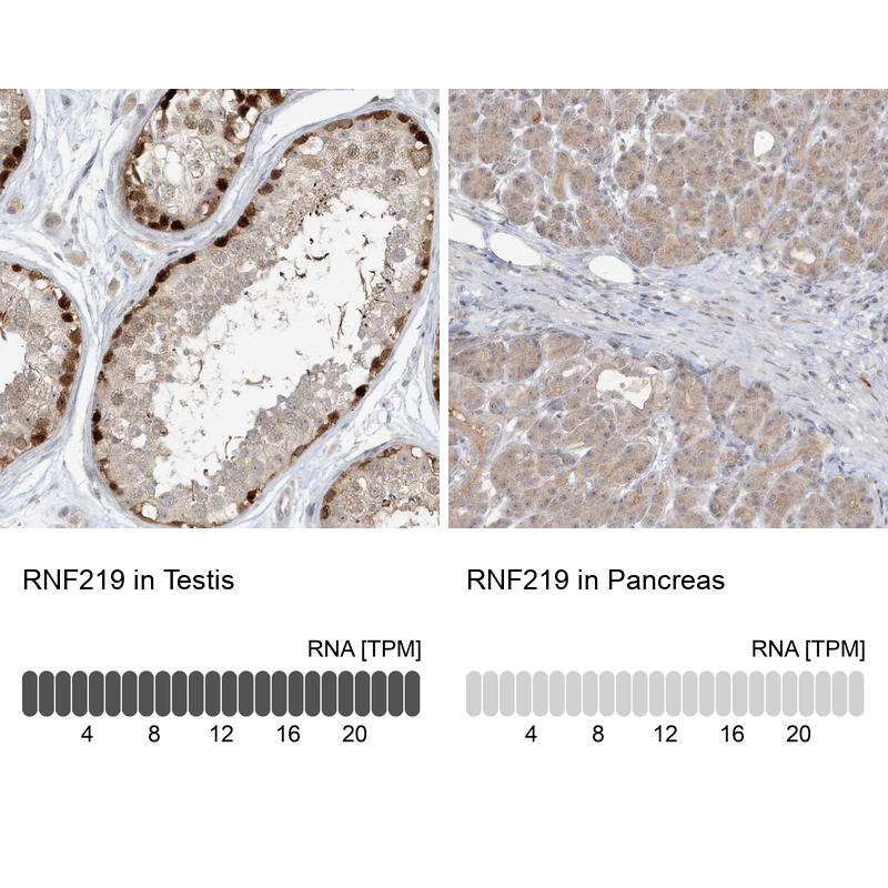 Atlas Antibodies Anti-RNF219 Antibody