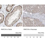 Atlas Antibodies Anti-RNF219 Antibody