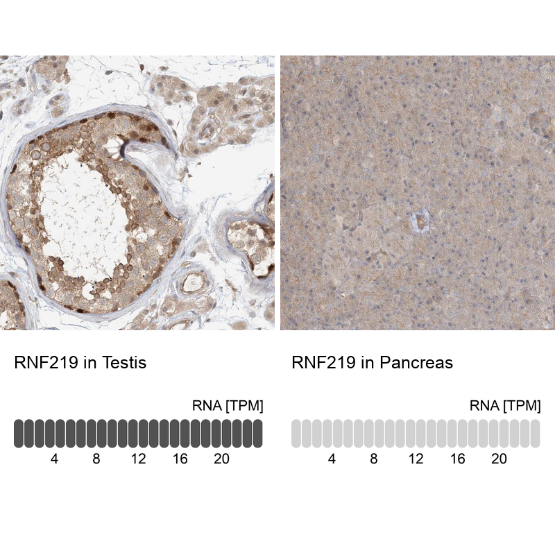 Atlas Antibodies Anti-RNF219 Antibody
