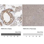 Atlas Antibodies Anti-RNF219 Antibody