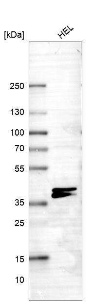 Atlas Antibodies Anti-RNF220 Antibody