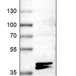 Atlas Antibodies Anti-RNF220 Antibody
