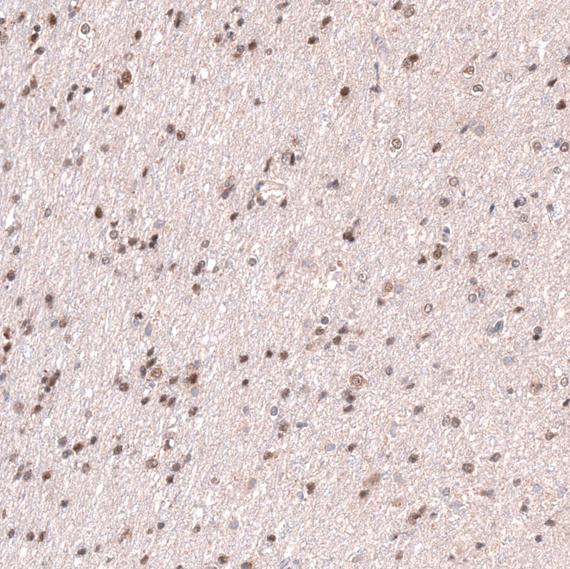Atlas Antibodies Anti-RNF220 Antibody