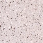 Atlas Antibodies Anti-RNF220 Antibody