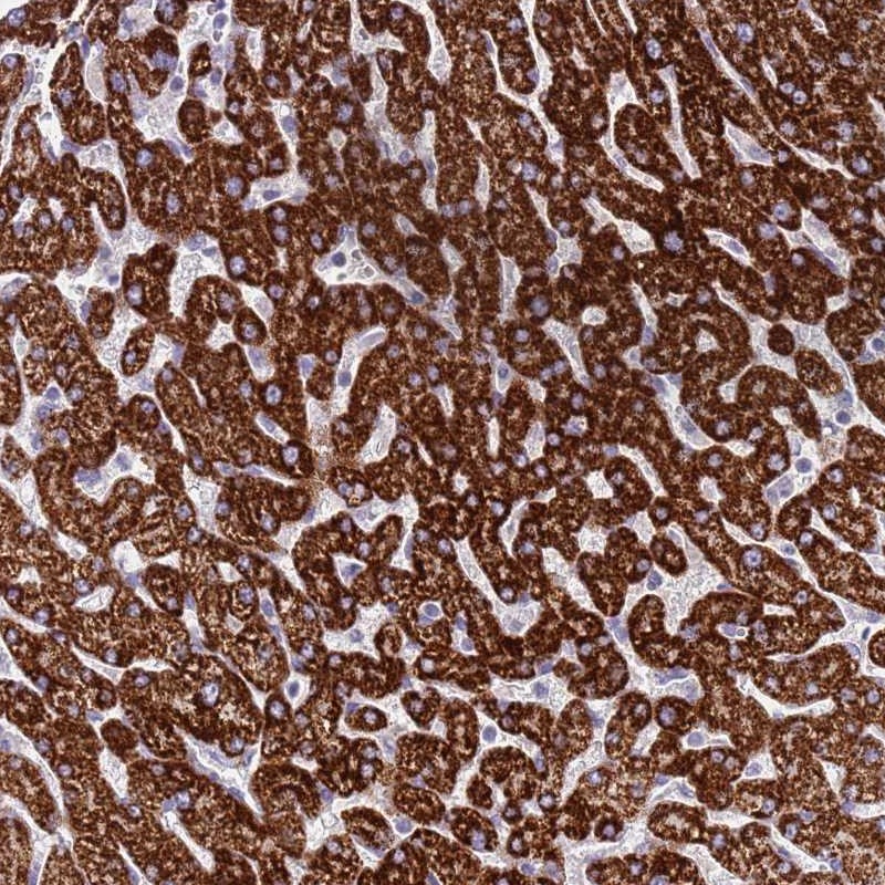 Atlas Antibodies Anti-RNF222 Antibody